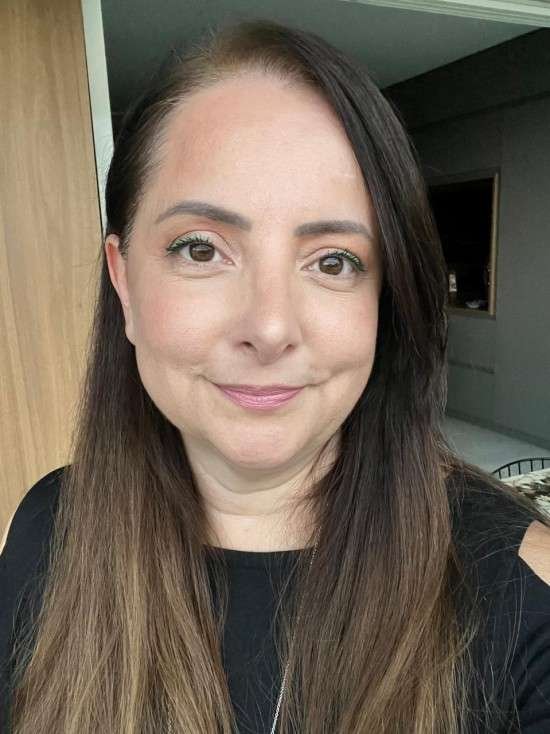 Ácido tranexâmico para melasma.