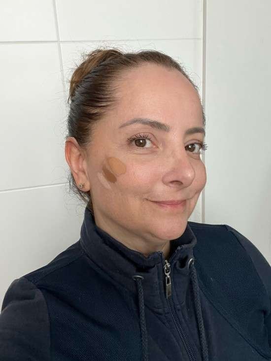 Subtom de pele o que é e como saber o seu.